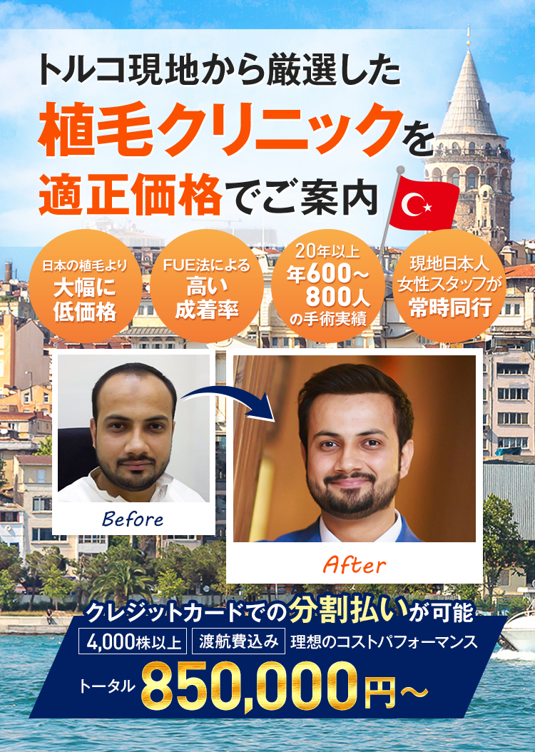 トルコ植毛案内所 厳選したトルコ植毛クリニックをご案内